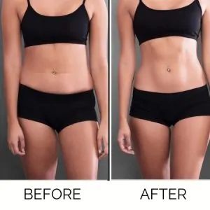 1Stop Clinic Befor-After 02