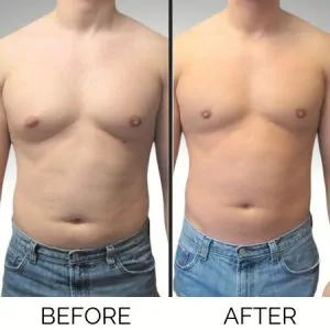 1Stop Clinic Befor-After 05