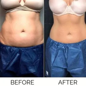 1Stop Clinic Befor-After 06