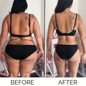 1Stop Clinic Befor-After 07